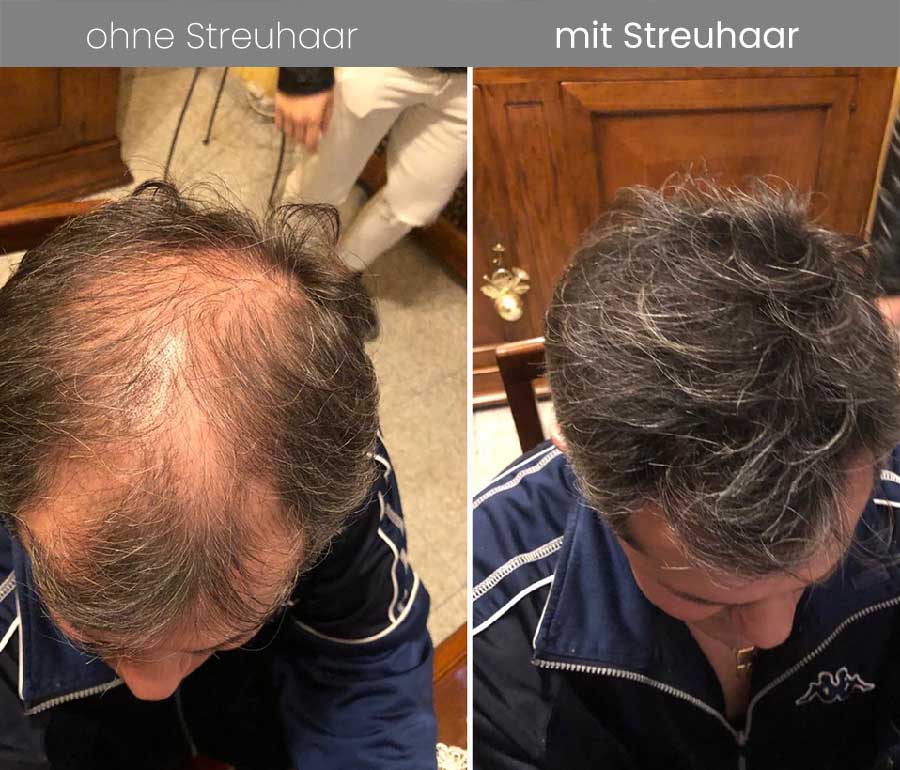 Streuhaar vorher nachher